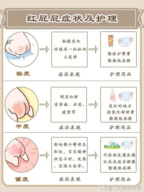 详细阅读:新生儿臀部护理全指南 新生儿臀部护理全指南