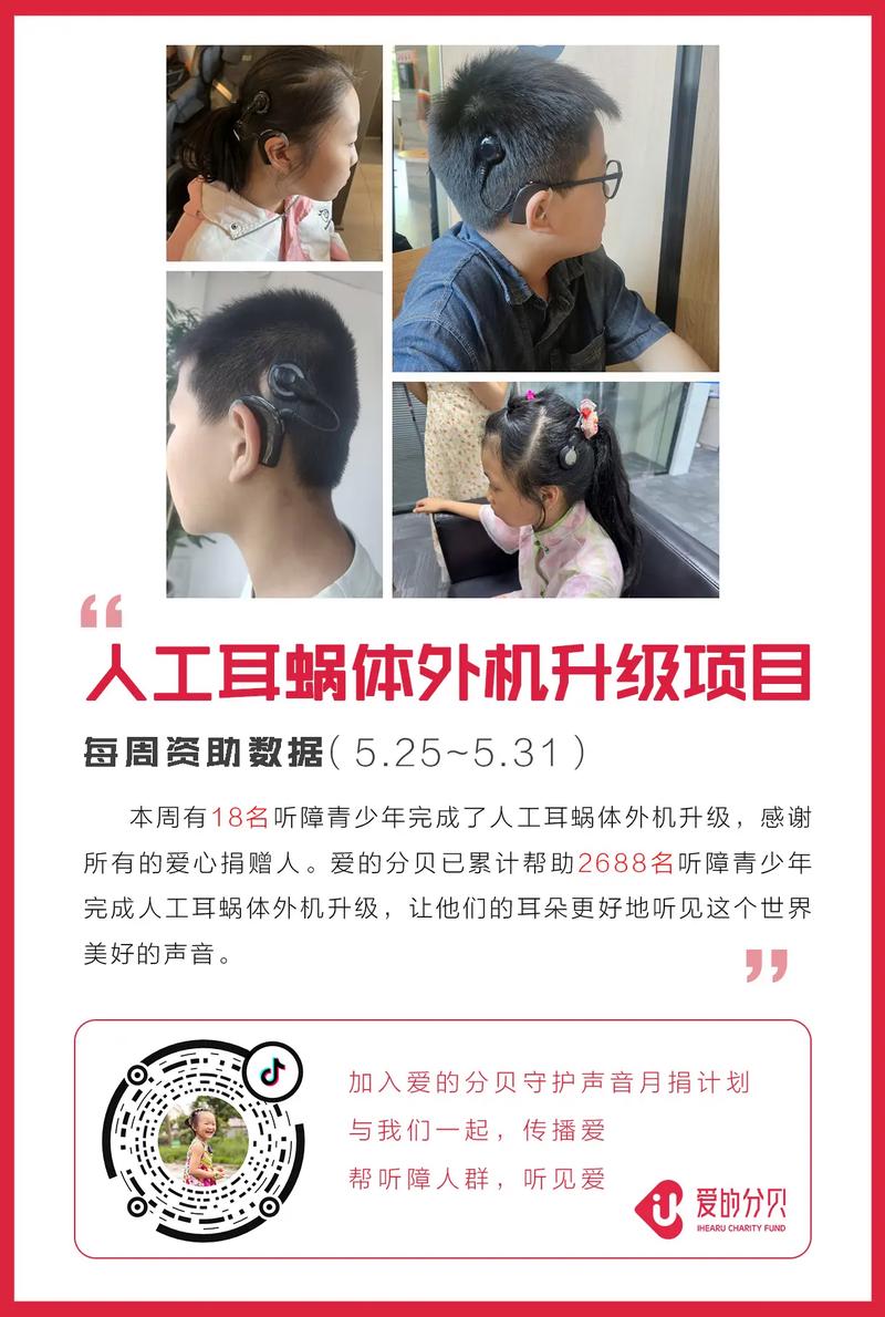 爱的分贝