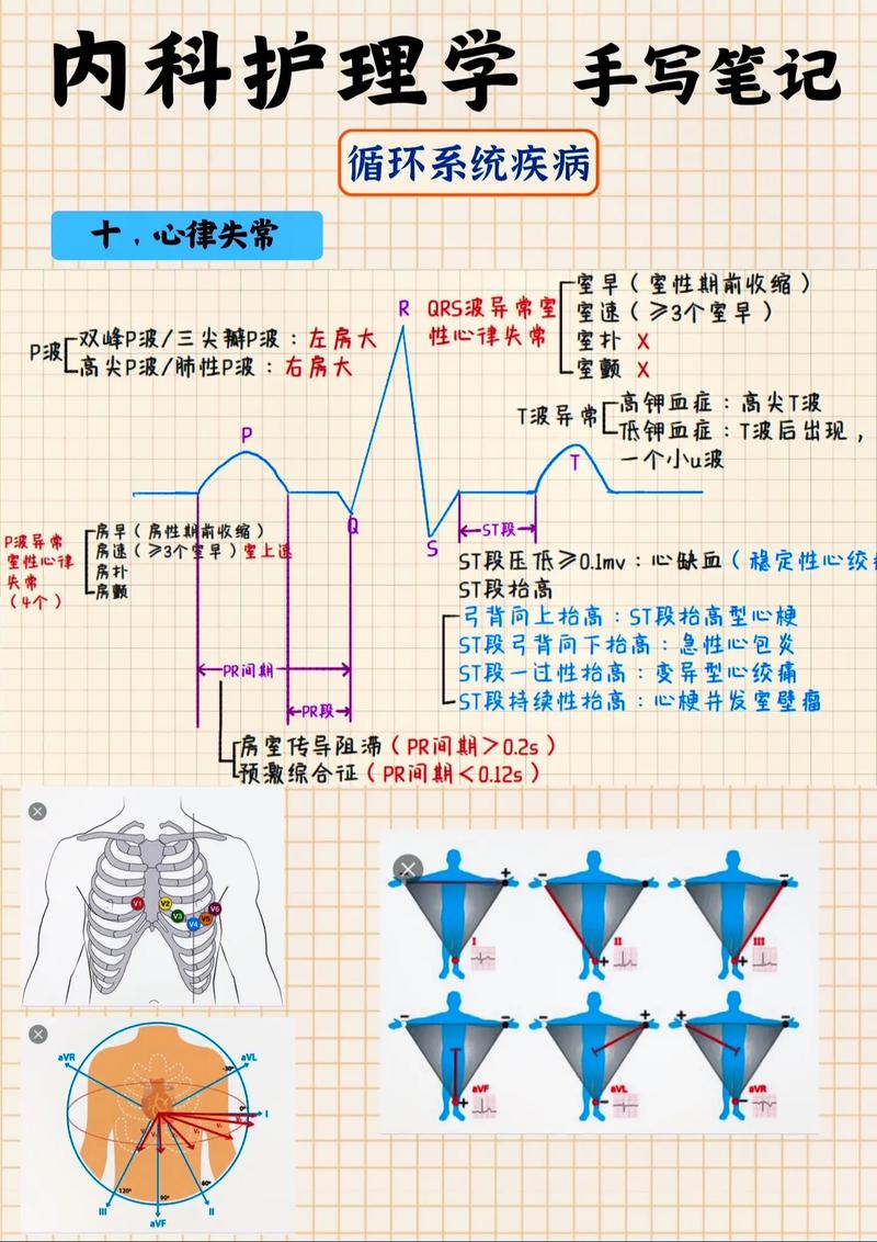 心律失常：心跳的“乱节奏”及其全面解析