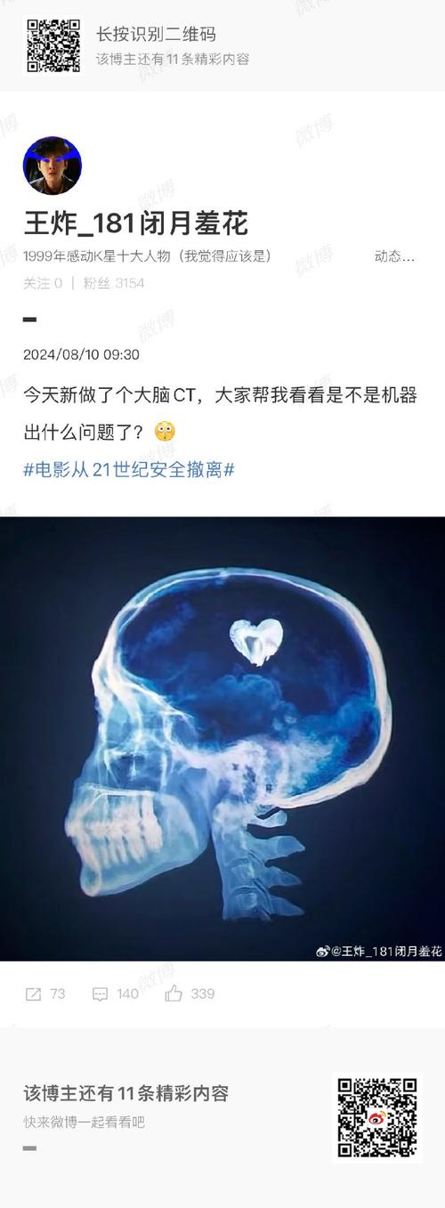 头痛：探寻背后的神秘面纱