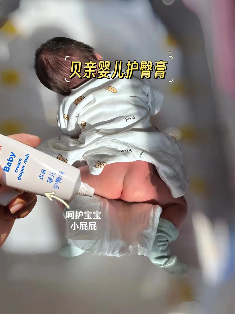 婴儿护臀膏：守护宝宝娇嫩臀部的温柔屏障