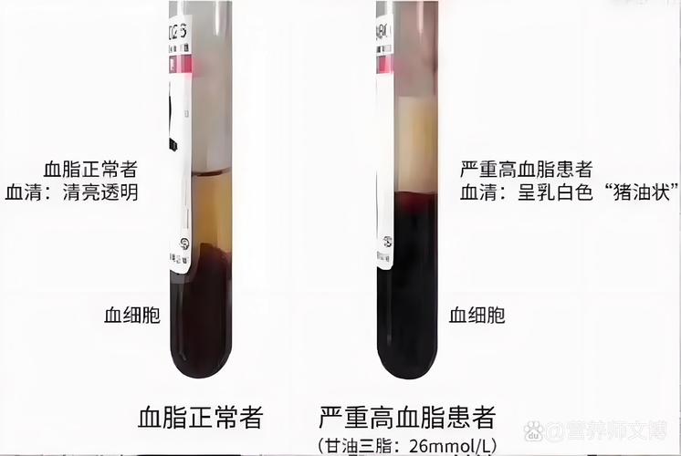 甘油三酯：人体内的“能量储存库”与健康隐患