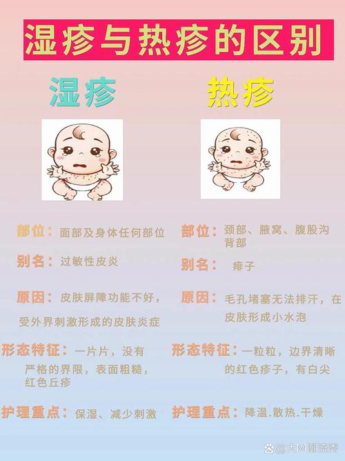 宝宝防湿疹：全方位守护宝贝肌肤
