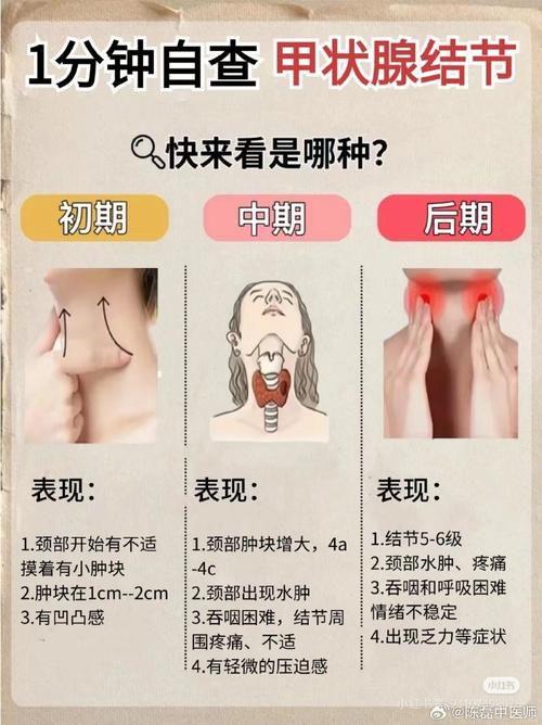甲状腺疾病的全面解析与治疗