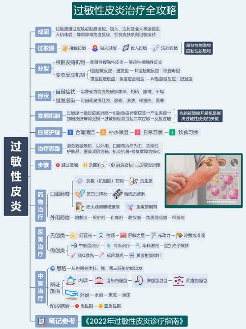 过敏症：了解、预防与治疗全攻略