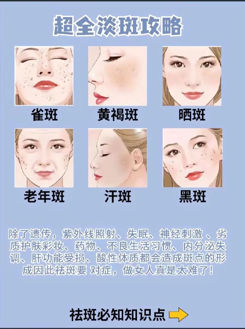 全面解析晒斑修复方法：从预防到治疗的全方位攻略