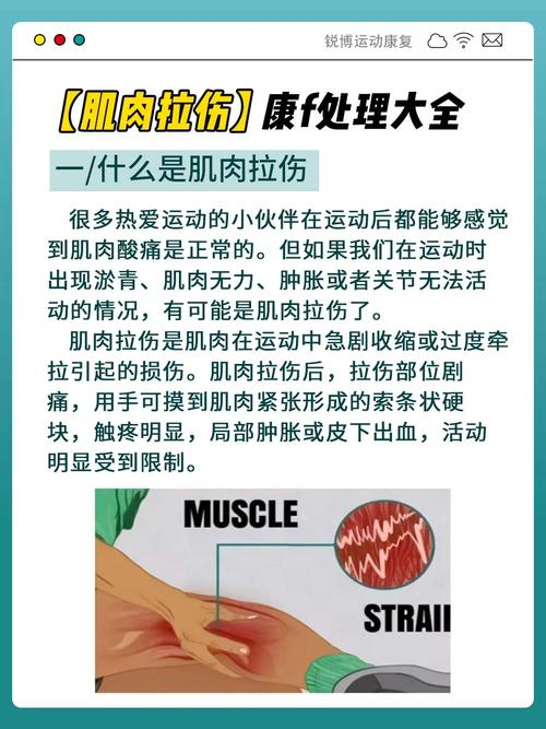 肌肉拉伤的全面处理与康复指南