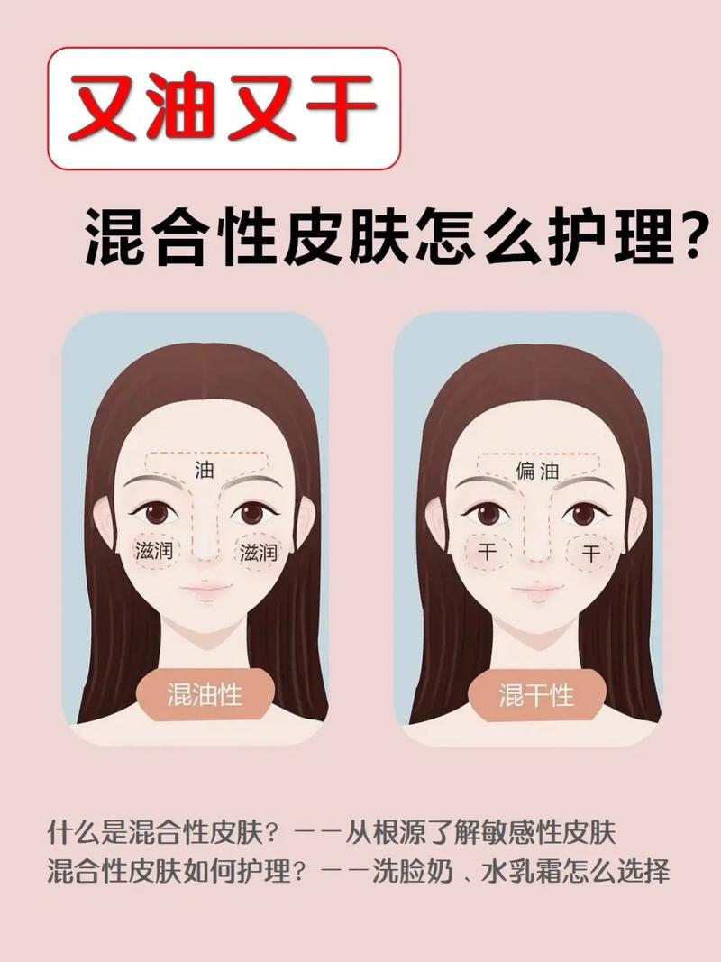 混油性肤质的全面解析与个性化护肤策略