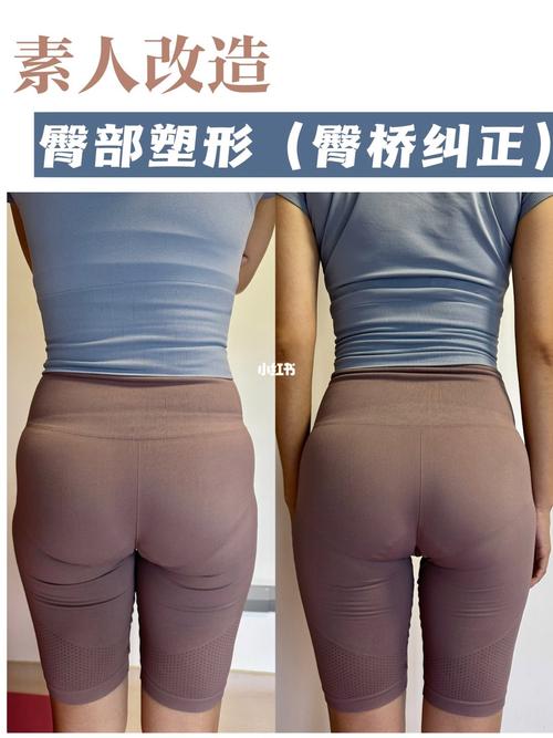 臀部塑形与护理要点：打造完美臀型的艺术