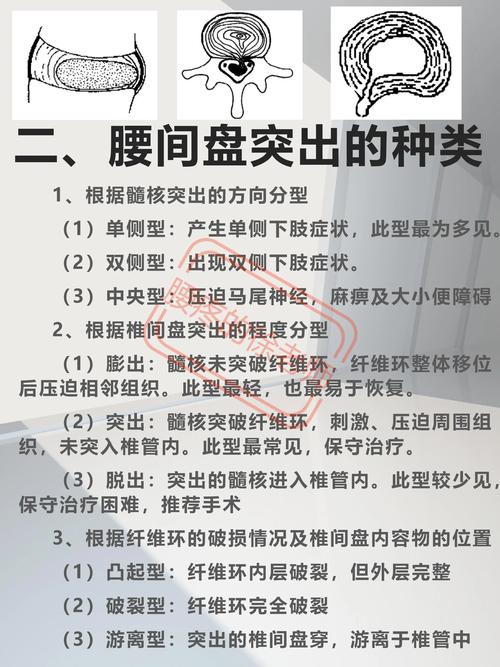 腰椎病的全面解析及应对策略