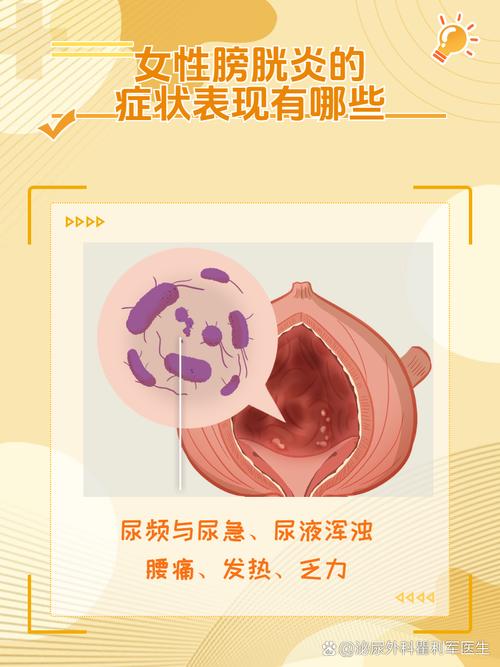 膀胱炎：女性健康的隐形杀手，你了解多少？