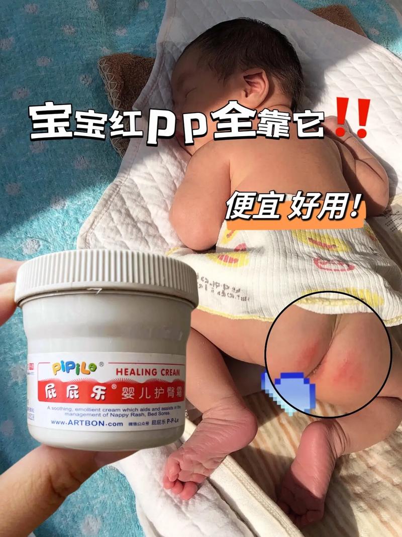 宝宝红屁屁的救星：护臀膏全解析与推荐
