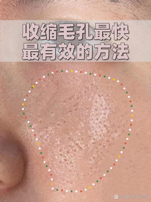 毛孔收缩紧致：解锁肌肤细腻光滑的秘密