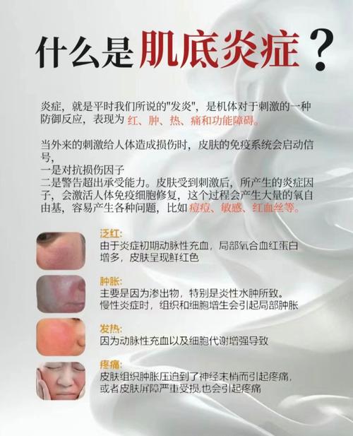 皮肤炎症消除：守护肌肤健康的关键之道