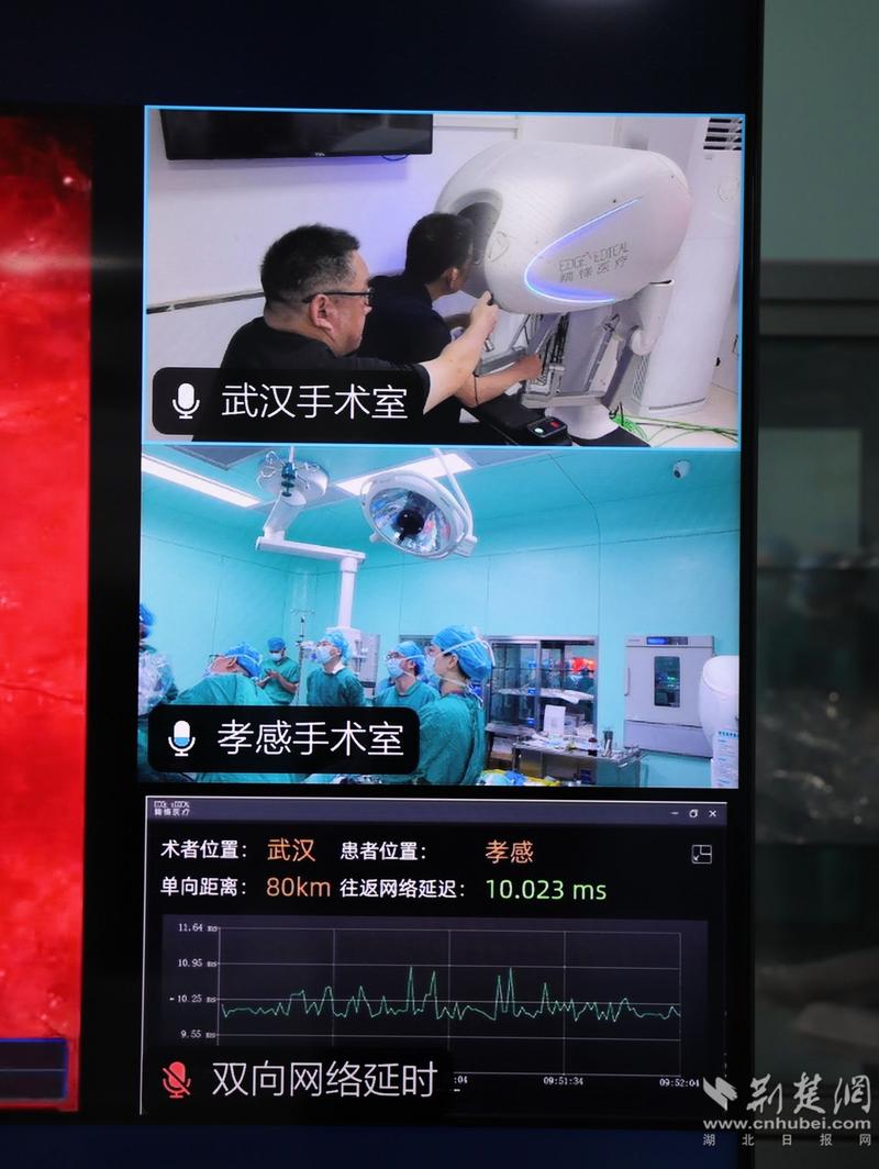 远程手术：医疗领域的革命性突破与深远影响
