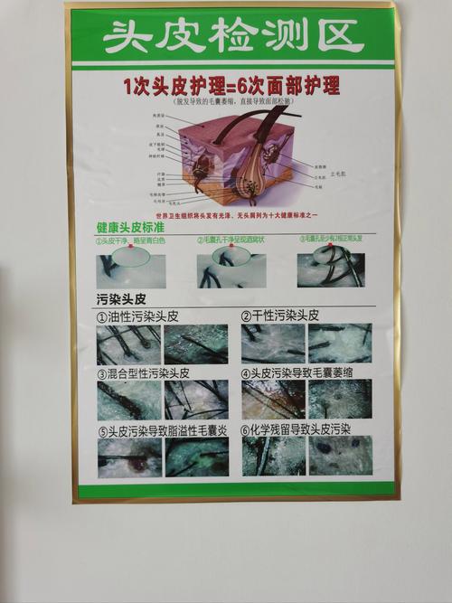 头发护理中头皮去角质的科学频率：呵护头皮与发丝的关键