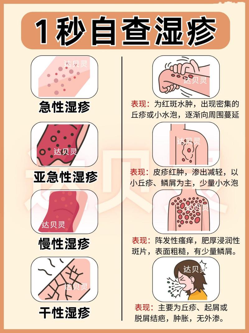 湿疹：了解、应对与预防