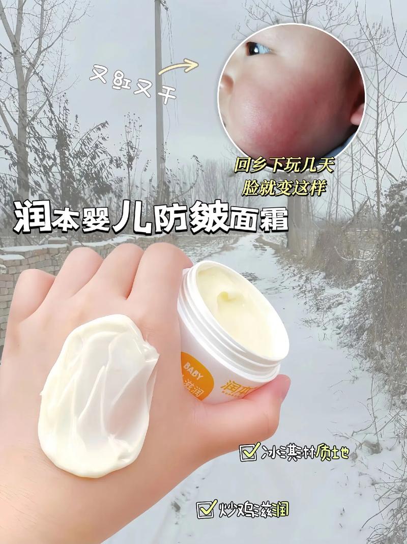 防皴面霜：守护肌肤，抵御干燥的贴心呵护
