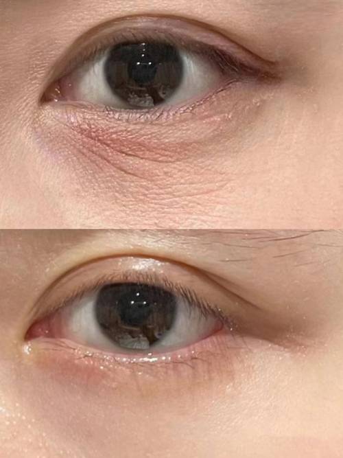 眼部细纹，如何巧妙淡化？