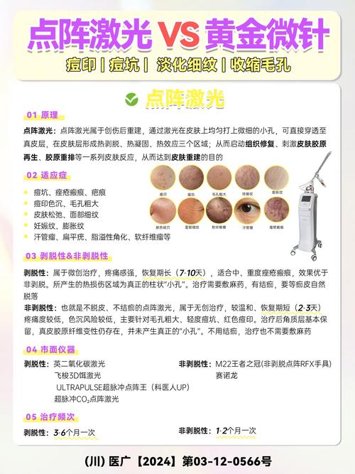点阵激光修复痘疤：全面解析与指南