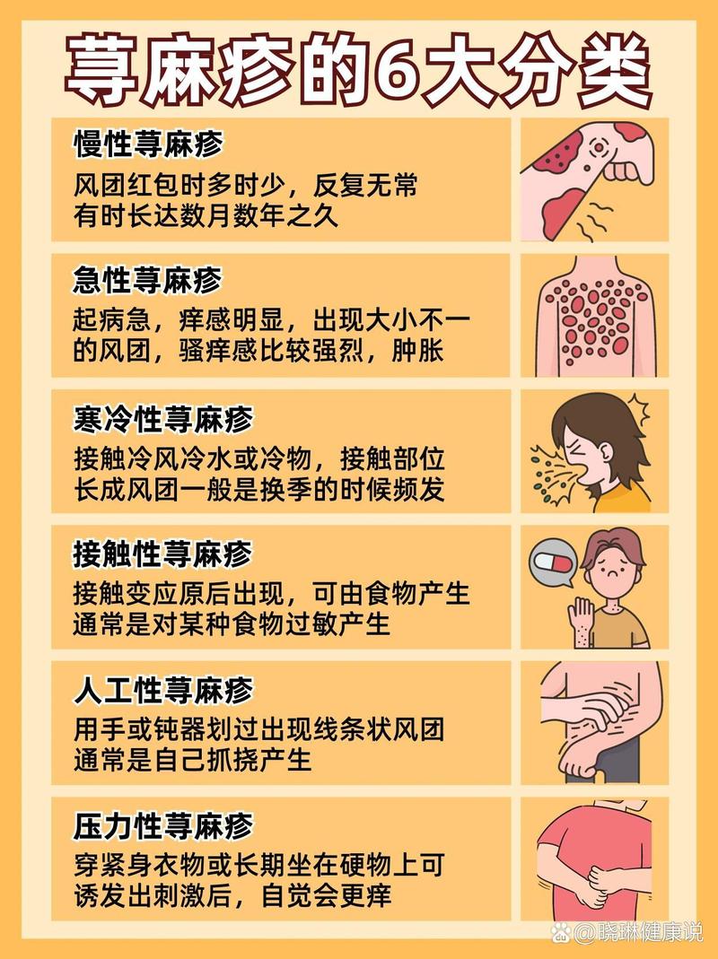 荨麻疹：了解与应对