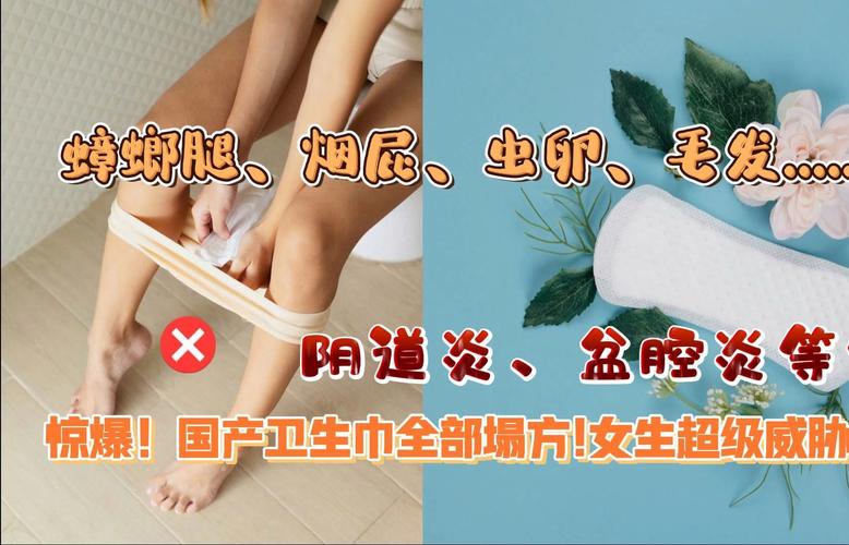 产后卫生巾使用不适的多面剖析与应对策略