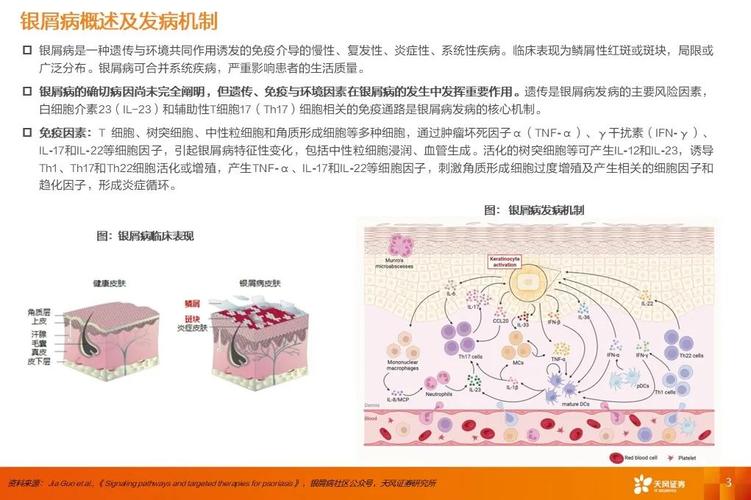 牛皮癣的治疗与控制：多维度综合管理策略