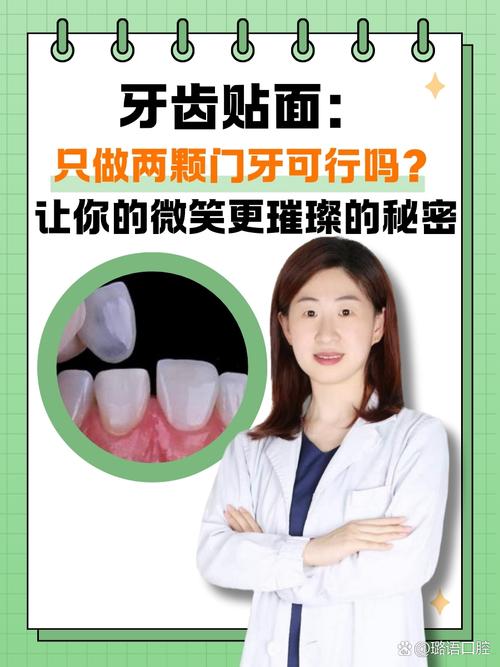 牙齿贴面美容：绽放自信微笑的神奇“面具”