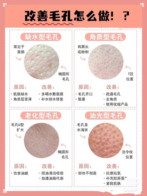 毛孔粗大改善：全面攻略，重塑肌肤细腻光泽
