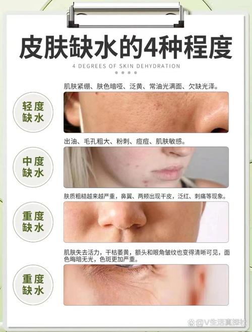 详细阅读:洗澡水温对皮肤的影响 洗澡水温对皮肤的影响