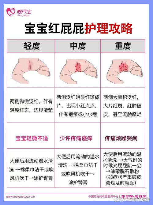 新生儿臀部护理全攻略，呵护宝宝娇嫩肌肤