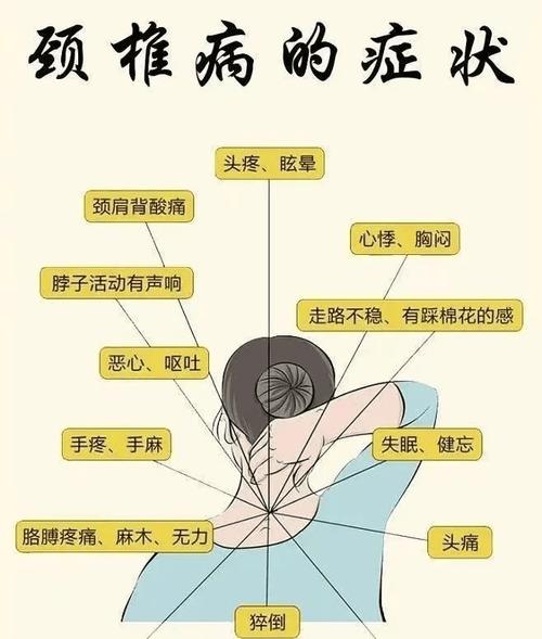 颈椎病：现代社会的健康“隐形杀手”