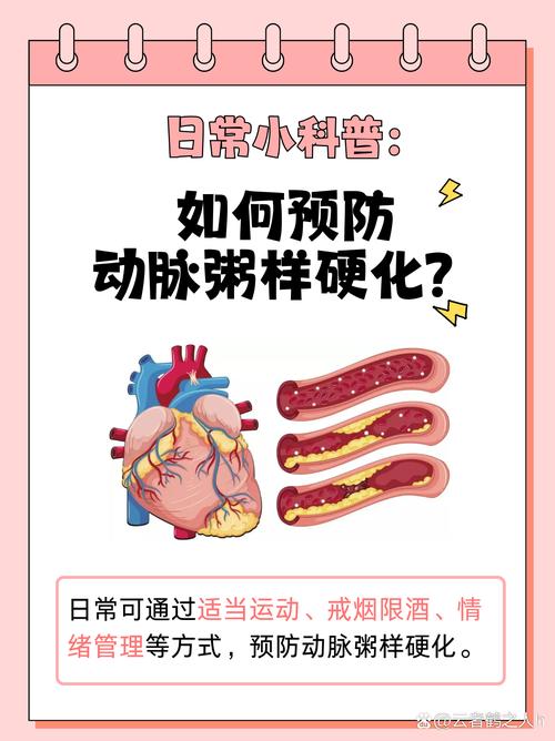 详细阅读:动脉粥样硬化的全面防治指南 动脉粥样硬化的全面防治指南