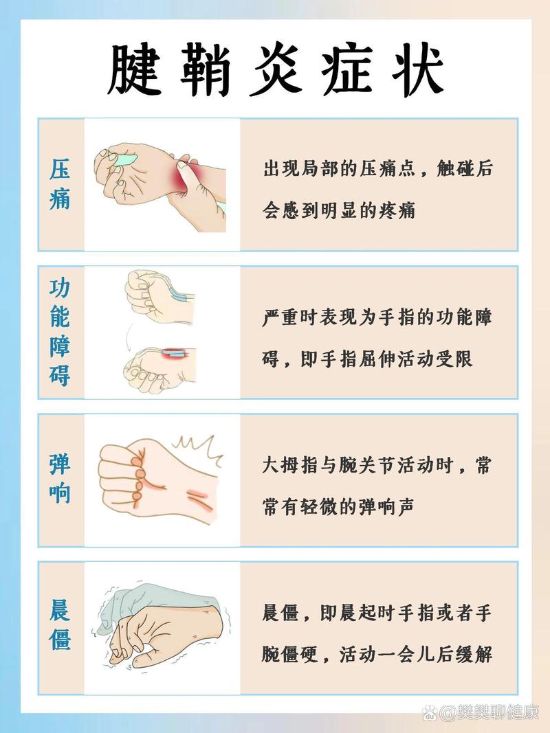 详细阅读:腱鞘炎的治疗方法 腱鞘炎的治疗方法