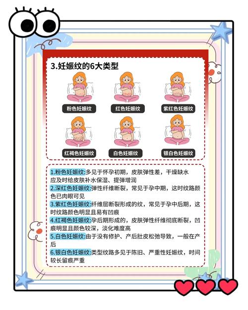 产后护理与妊娠纹预防全攻略