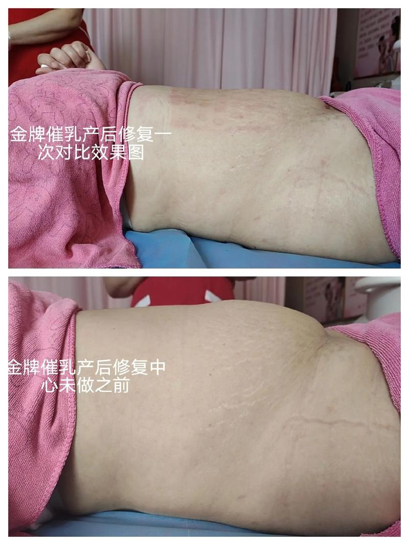 产后护理与产后康复：深度对比与科学抉择