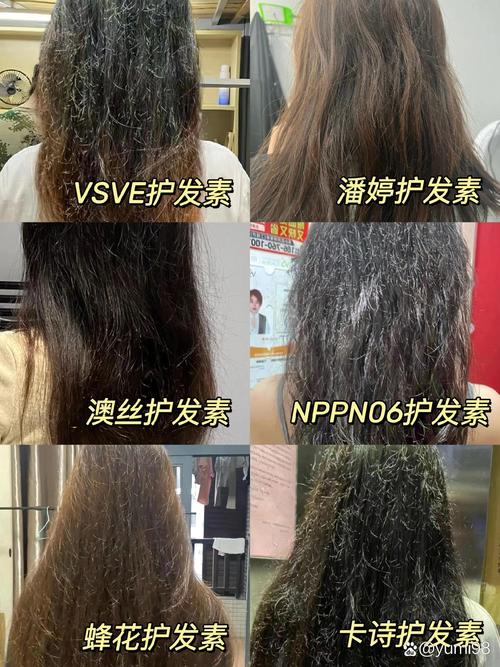 详细阅读:压力性脱发救星:护发素的神奇守护力 压力性脱发救星:护发素的神奇守护力