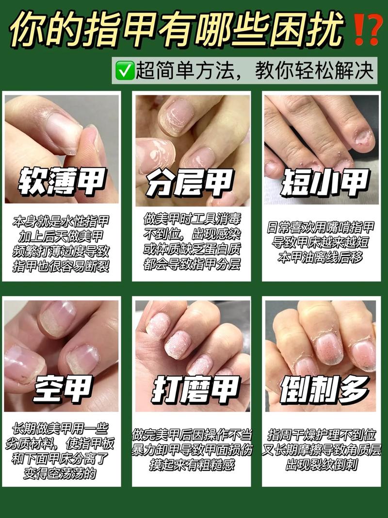 指甲保养的全面指南：方法与技巧全解析