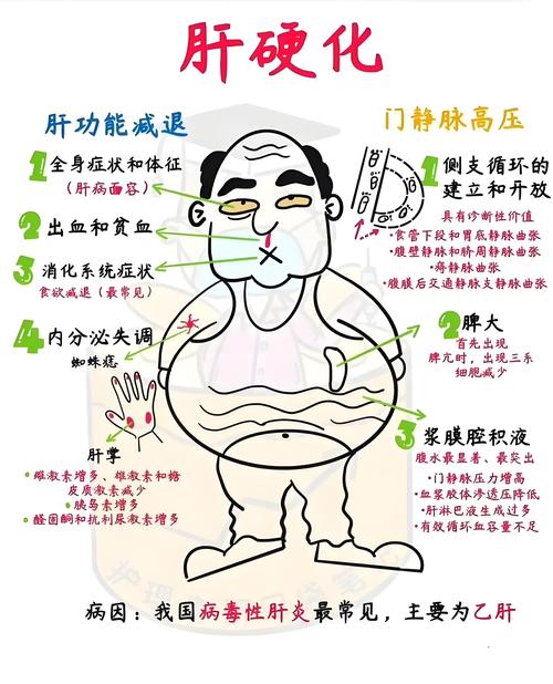 肝硬化：症状、病因与治疗全解析