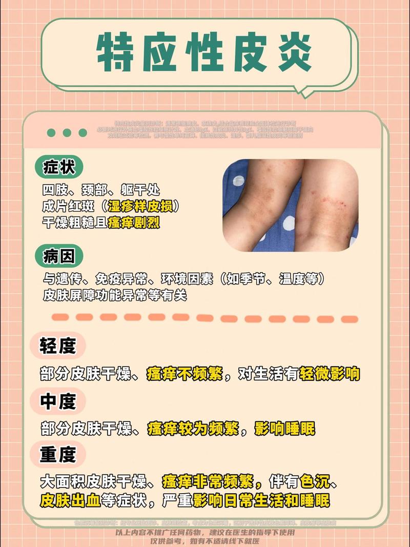 认识皮炎：成因、类型、症状及防治全攻略