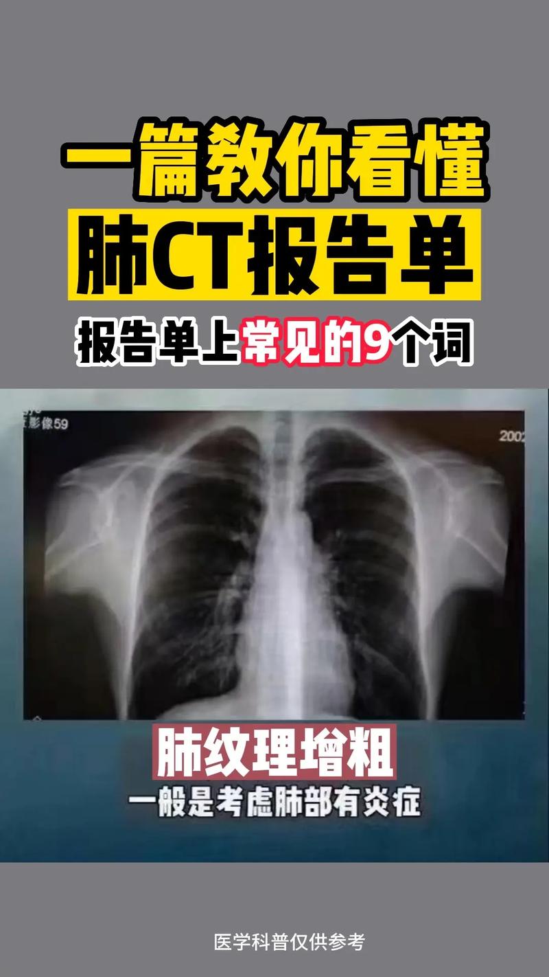 肺炎的早期症状