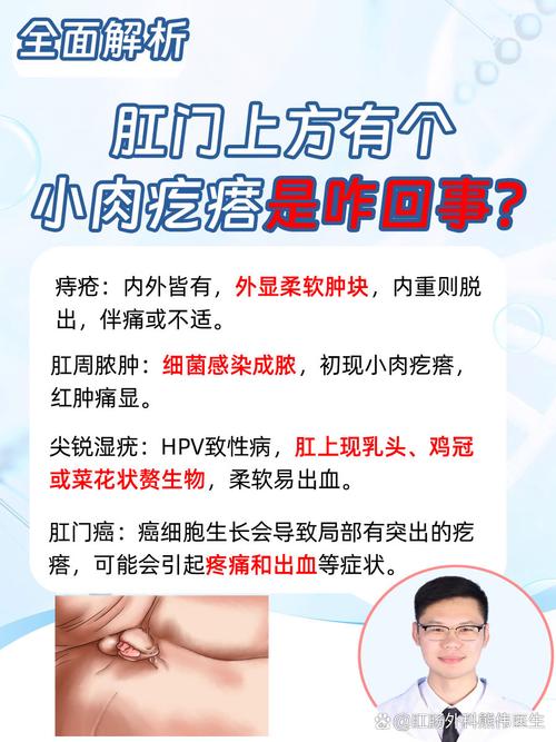 痔疮的治疗与预防：全面解析