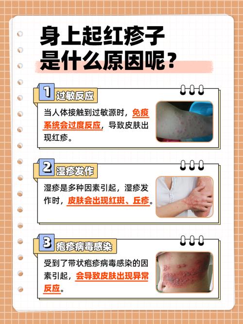 探秘过敏：症状、成因与治疗全解析