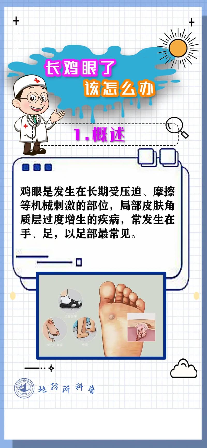 以下是关于鸡眼的治疗与预防的详细内容：