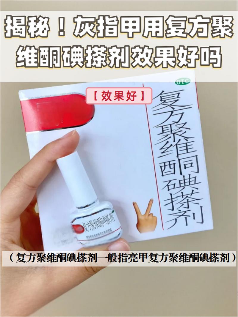 灰指甲的治疗方法大揭秘：从药物治疗到日常护理，一文搞定！