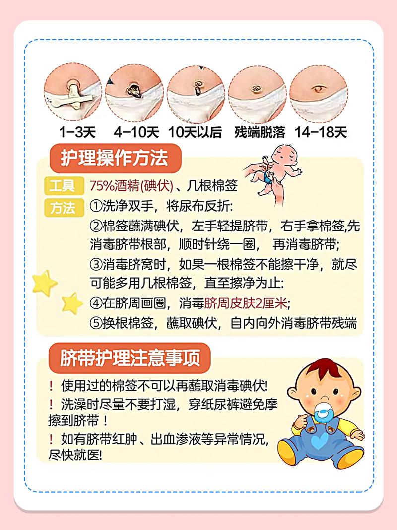 新生儿脐带护理：全方位呵护宝宝健康的关键