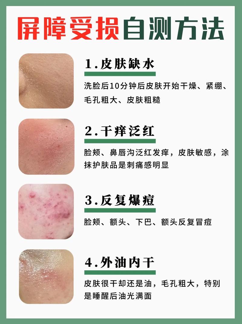 肌肤屏障：守护健康，绽放光彩