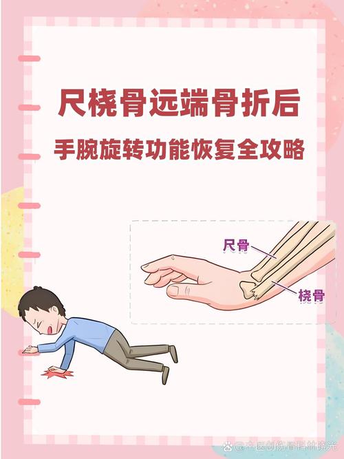 骨折：了解、应对与康复全攻略