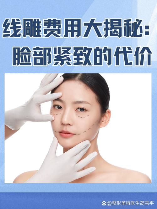 线雕提升紧致：重塑青春容颜的神奇密码