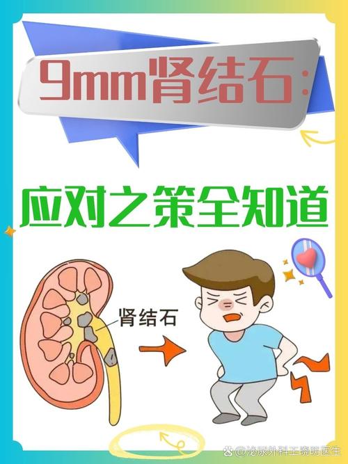 详细阅读:肾结石:了解它,才能战胜它 肾结石:了解它,才能战胜它